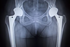 Product Liability