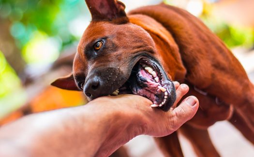 Dog Bite Case