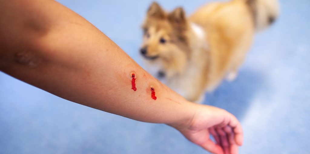 Dispelling The Top Myths About Dog Bites