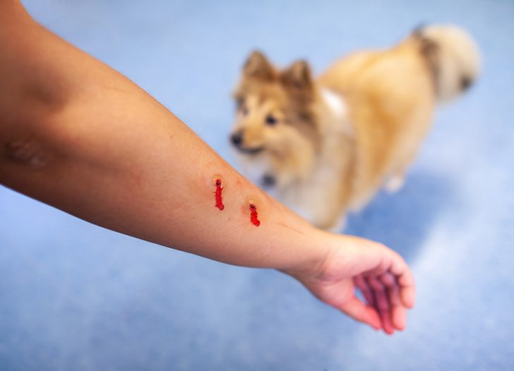 Managing Nerve Damage After a Dog Bite Injury Mazow McCullough PC