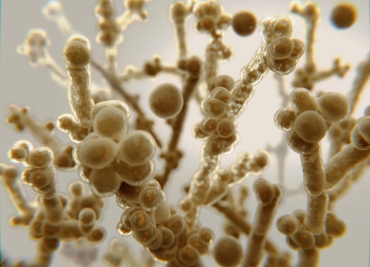 Fungus-Related Nursing Home Wrongful Death On the Rise